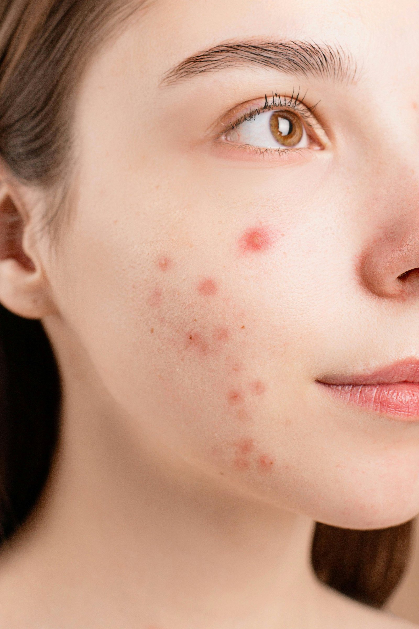 Dermatology